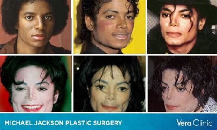 Zack Braff's Plastic Surgery Journey Revealed
